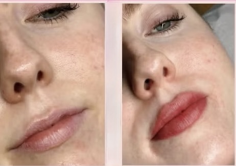 Before & After
